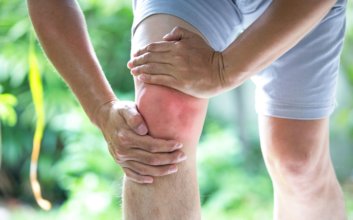 specialist in arthritis in Houston