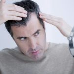What is hair transplant surgery