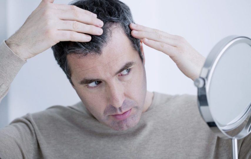 What is hair transplant surgery