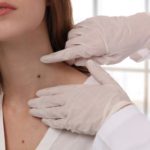 How To Determine When Do I Need A Skin Cancer Check?