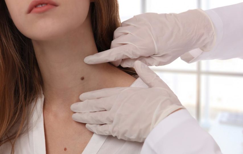 How To Determine When Do I Need A Skin Cancer Check?