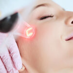 Does the Fractional Co2 Laser Treatment Really Work