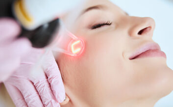 Does the Fractional Co2 Laser Treatment Really Work